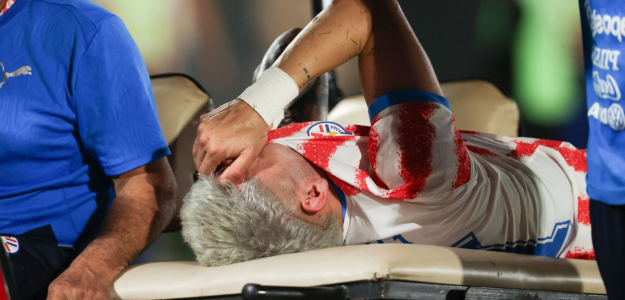 Julio Enciso en duda para el debut de Paraguay en el Mundial
