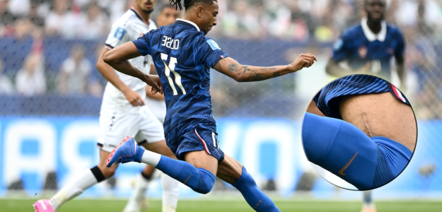Michael Olise: El talento francés marcado por la adversidad
